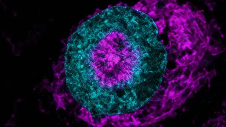 Immagine al microscopio di una cellula tumorale evidenziata con colorazione fluorescente