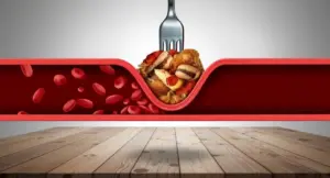 Illustrazione di un'arteria ostruita da cibi ricchi di grassi saturi